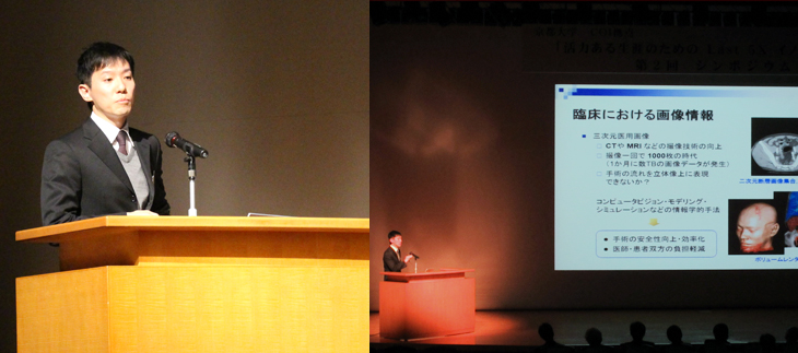 グループ4：京都大学大学院 情報学研究科 中尾 恵准教授「三次元画像に基づく手術プロセスの半自動計画と時系列分析」